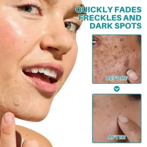 Fivfivgo® Botanical Freckles & Spot Removal Patch