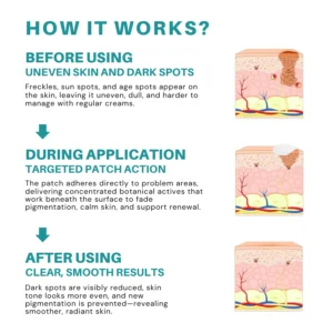 Fivfivgo® Botanical Freckles & Spot Removal Patch