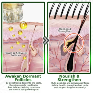  flysmus® Microneedle Herbal Infusion Hair Stimulation Set